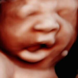 Photo Gallery Pittsburgh 4D Elective elective 5d ultrasounds