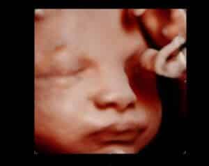 Photo Gallery Pittsburgh 4D Elective Ultrasound baby face photo Pittsburgh PA