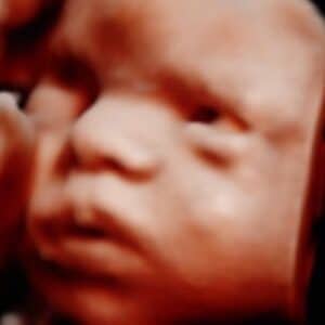 Photo Gallery Pittsburgh 4D Elective Pittsburgh PA 3D ultrasound keepsake photo