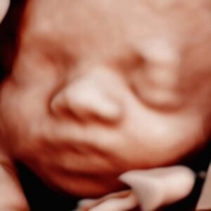 Photo Gallery Pittsburgh 4D Elective Detailed HD ultrasound baby image Pittsburgh