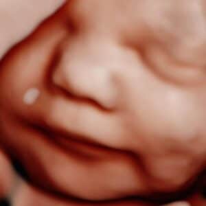 Photo Gallery Pittsburgh 4D Elective HD live style ultrasound photo Pittsburgh PA