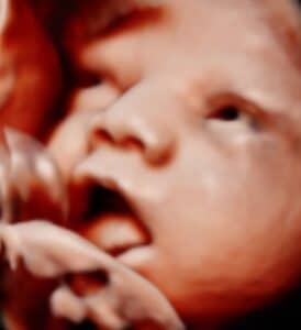 Photo Gallery Pittsburgh 4D Elective Pittsburgh HD ultrasound keepsake image