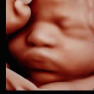 Photo Gallery Pittsburgh 4D Elective My Little Pumpkin 4D Pittsburgh ultrasound photo