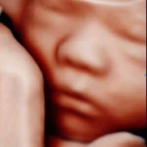 Photo Gallery Pittsburgh 4D Elective Elective ultrasound photo Pittsburgh PA