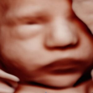 Photo Gallery Pittsburgh 4D Elective Keepsake baby ultrasound photo in Pittsburgh PA