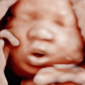 Photo Gallery Pittsburgh 4D Elective Clear 4D ultrasound baby photo Pittsburgh PA