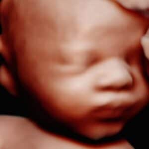 Photo Gallery Pittsburgh 4D Elective 4D baby ultrasound image Pittsburgh Pennsylvania