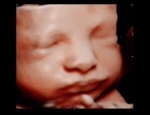 Photo Gallery Pittsburgh 4D Elective Pittsburgh PA 4D ultrasound keepsake photo