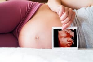 Home Pittsburgh 4D Elective 4d/hd elective ultrasound Pittsburgh