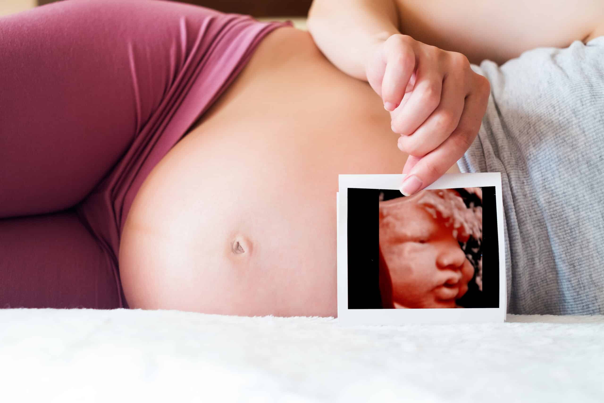 4d/hd elective ultrasound Pittsburgh