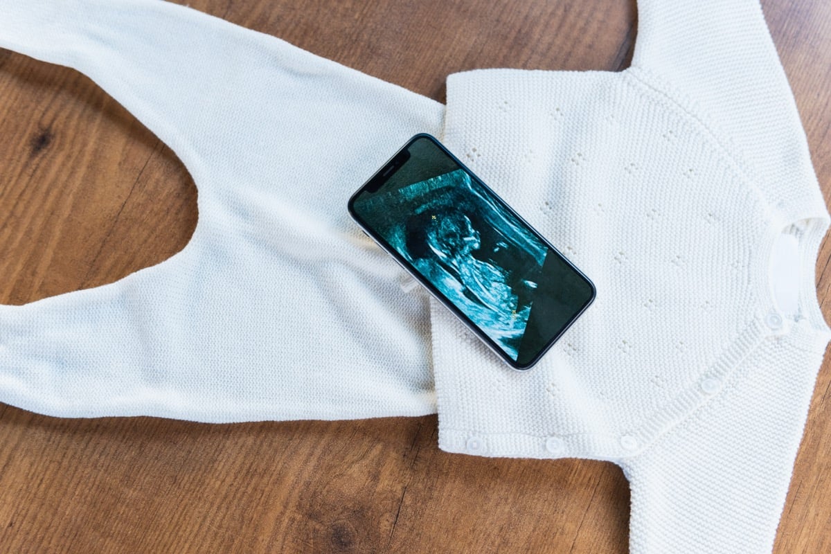 4D Ultrasound Near Murrysville PA: Book Your Pittsburgh Keepsake Session Pittsburgh 4D Elective Pittsburgh 4D Elective ultrasound_ 4dhdelectiveultrasound 32