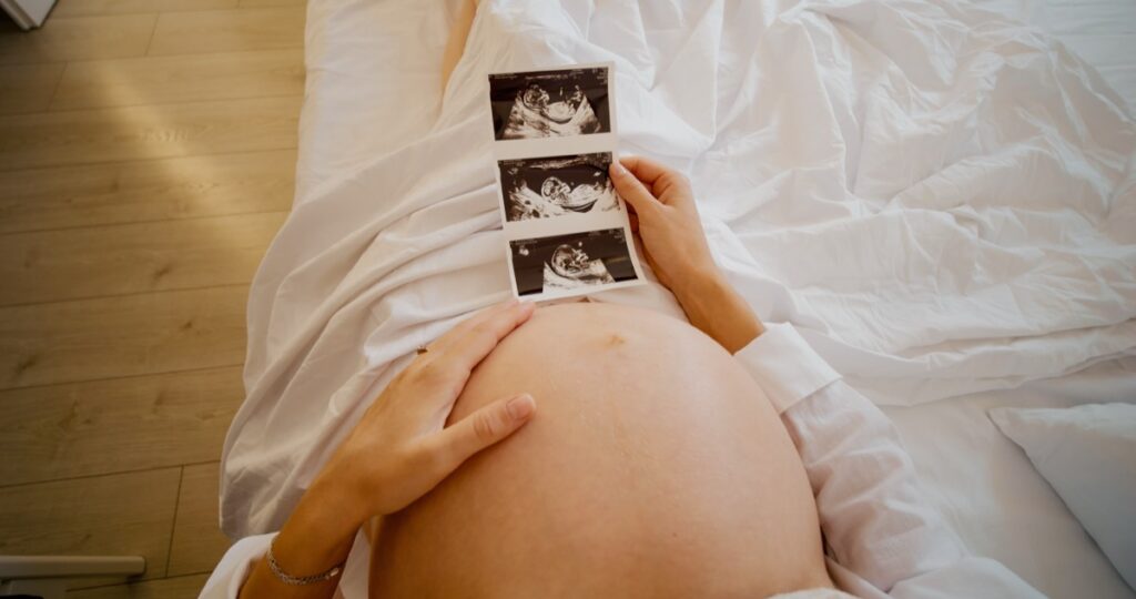 4D Ultrasound Near Wexford PA: Book Your Keepsake Session in Pittsburgh Pittsburgh 4D Elective Pittsburgh 4D Elective ultrasound_ 4dhdelectiveultrasound 38