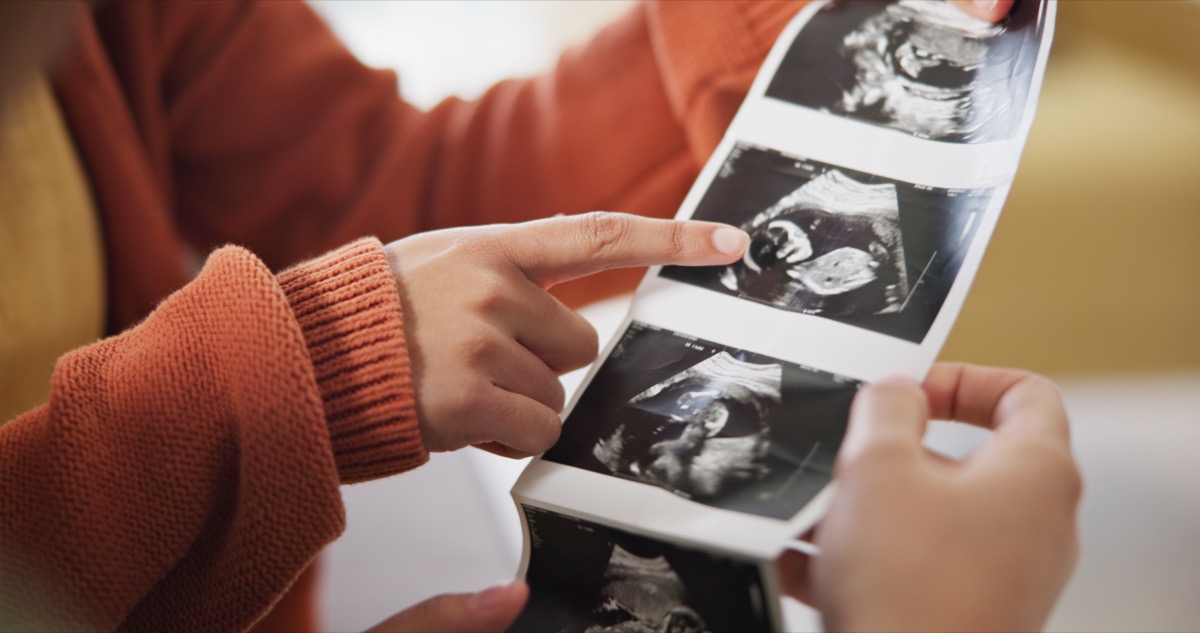 Elective Ultrasound as a Pregnancy Gift in Pittsburgh Pittsburgh 4D Elective Pittsburgh 4D Elective ultrasound_ 4dhdelectiveultrasound 41