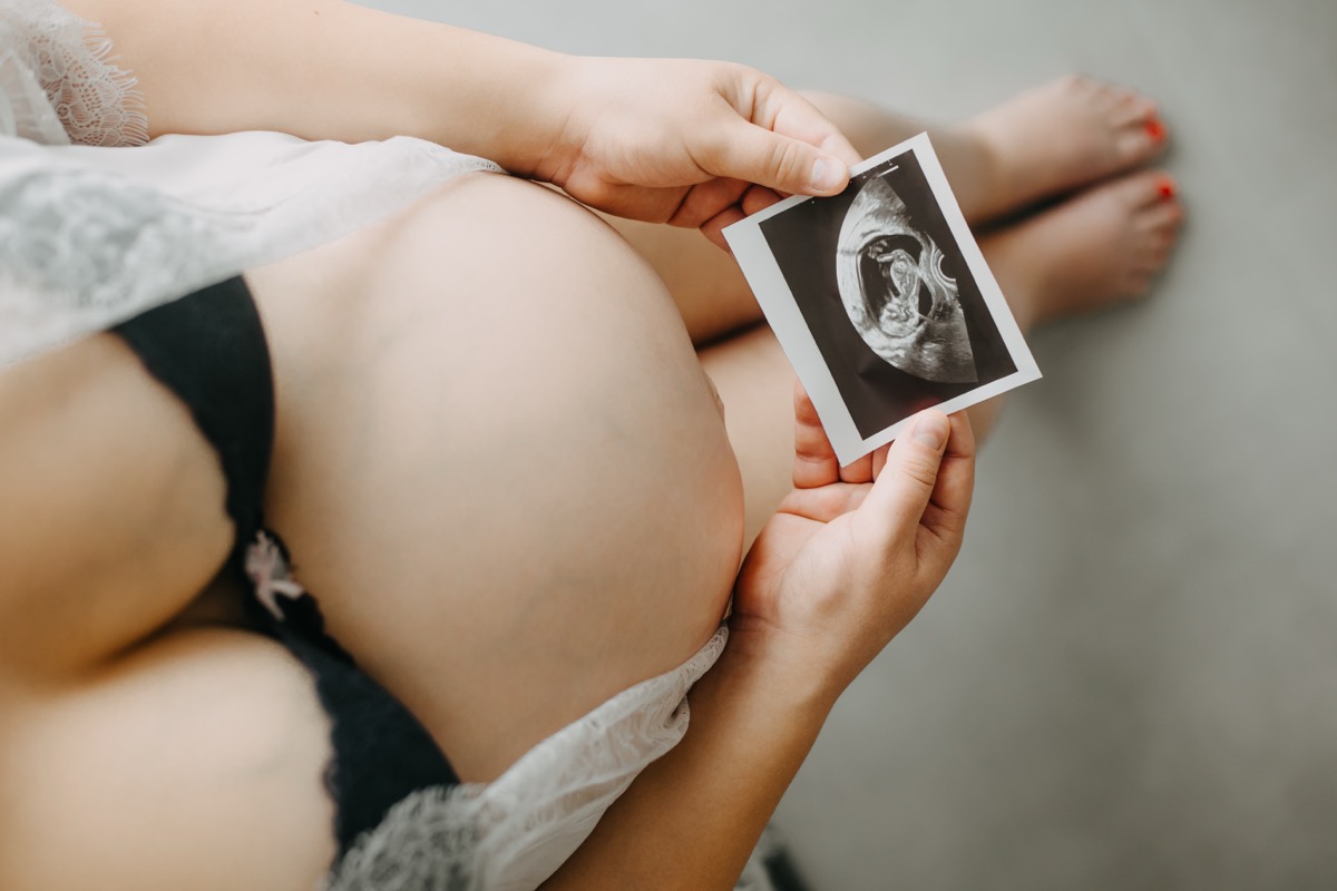 Prenatal Bonding Benefits: How Elective Ultrasound Connects You to Your Baby Pittsburgh 4D Elective Pittsburgh 4D Elective ultrasound_ 4dhdelectiveultrasound 44